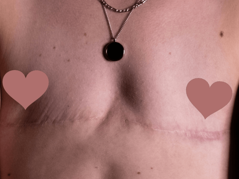 “Feminist” Fetishization of Trans&nbsp;Men